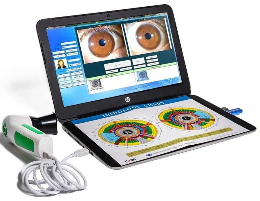 Iris Analysis Machine